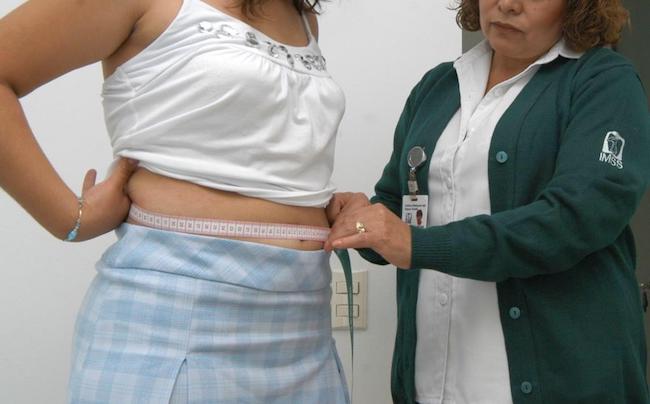 Photo of A cuidar el hígado graso: IMSS