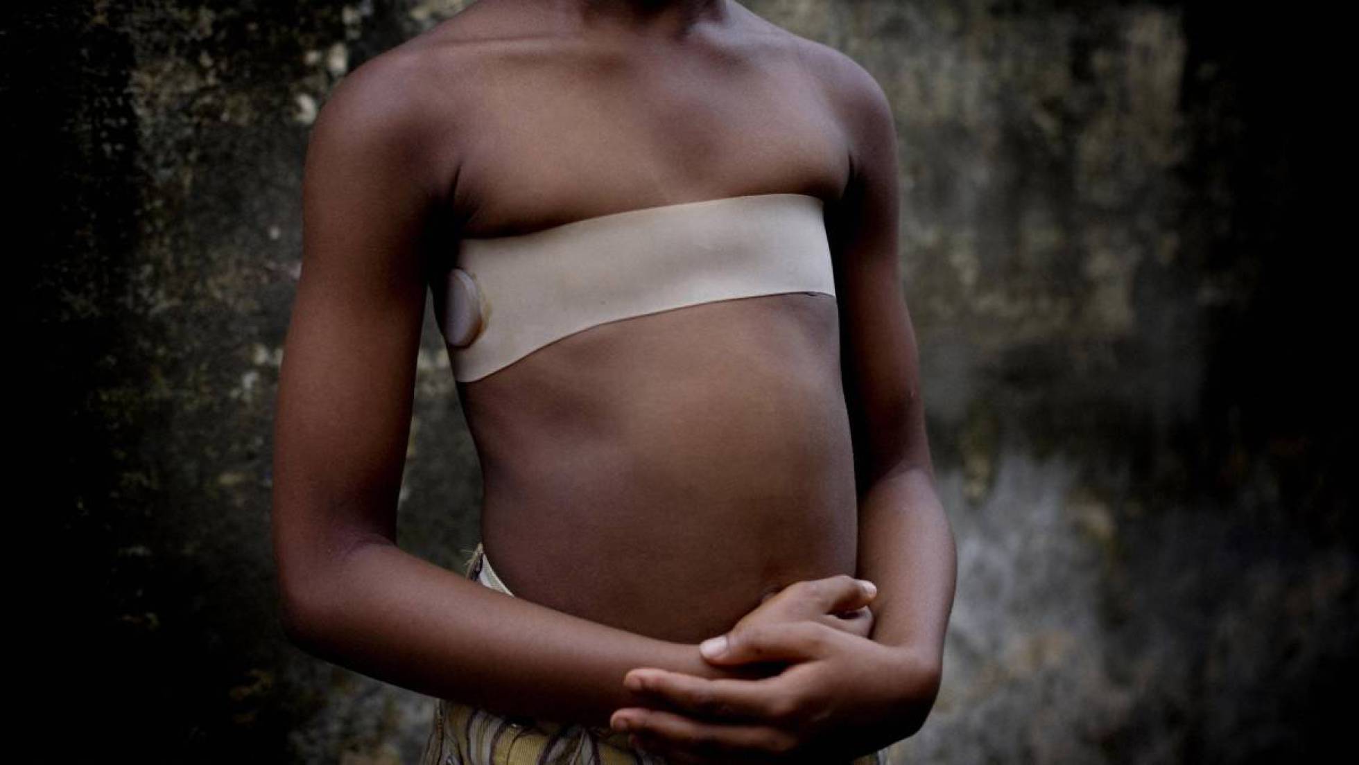 Photo of Planchado de senos: una tortura a las niñas para que no lleguen a mujeres