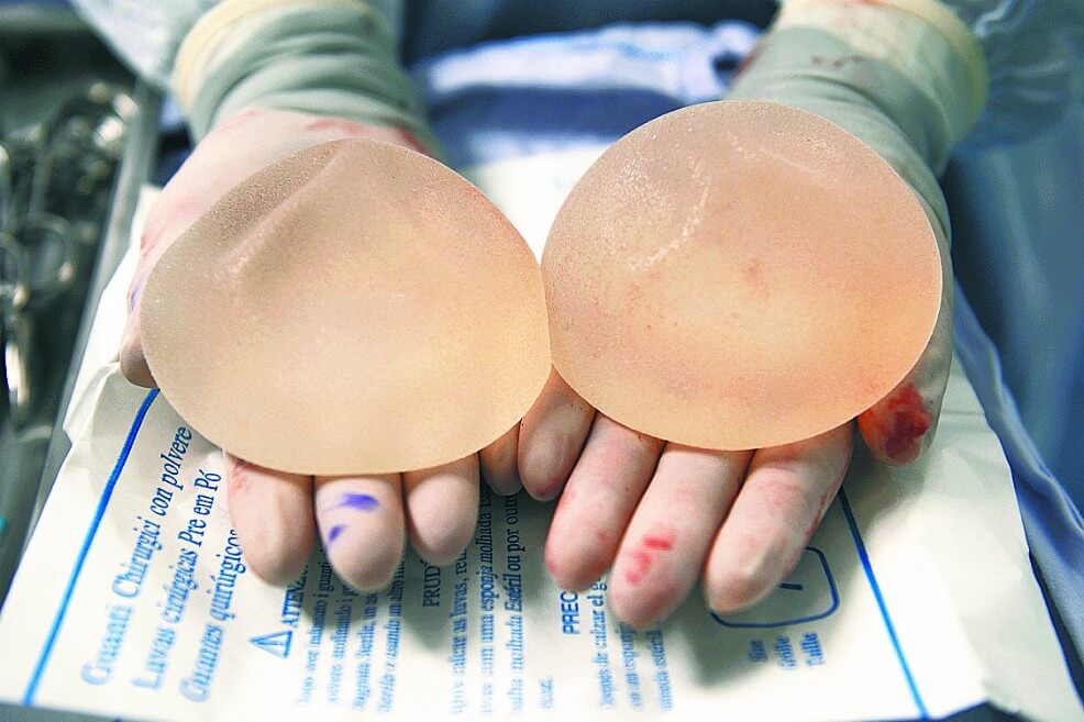 Photo of Implantes mamarios de Allergan son retirados del mercado por riesgo de cáncer