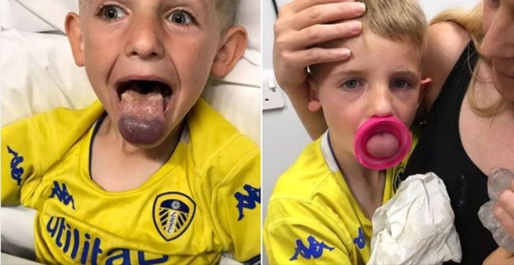 Photo of Niño casi muere tras quedarse atrapada su lengua en una botella de plástico