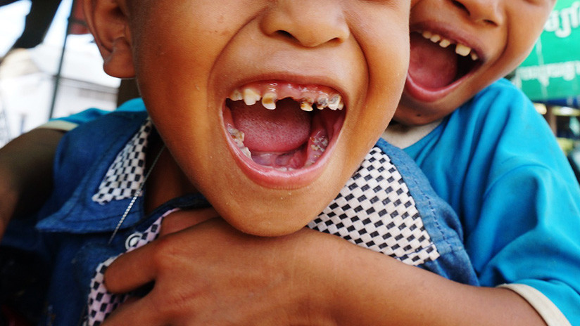 Photo of Extraen más de 500 dientes a un niño indio de 7 años