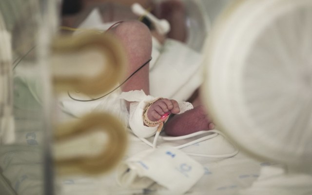 Photo of Nacimiento de bebé sin rostro genera escándalo de negligencia