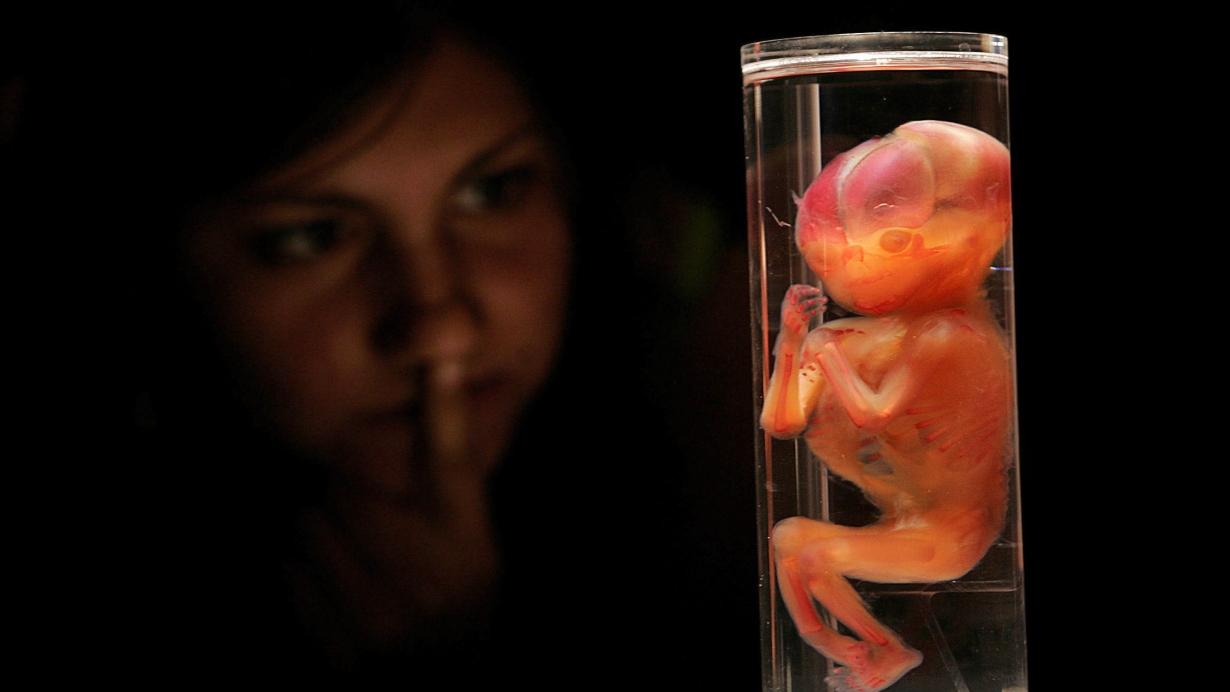 Photo of ¿Por qué la bioética permite el aborto hasta las 12 semanas?