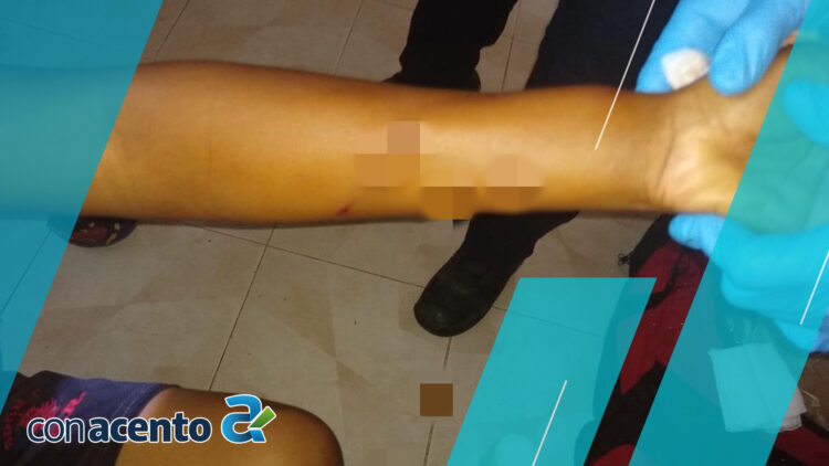 Photo of Adolescente es herido con escopeta en Motul