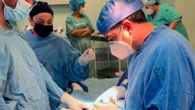 Photo of Cirujanos del IMSS reconstruyen cabeza de niño atacado por un perro