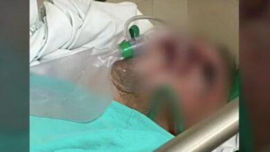 Photo of Murió Gregorio, primer caso sospechoso de hongo negro tras Covid en México