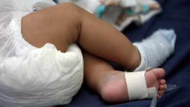Photo of Bebé de 2 años en coma tras intoxicación con cocaína
