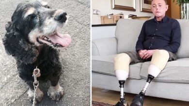 Photo of Hombre pierde dedos, piernas y parte de su cara por lamida de su perro