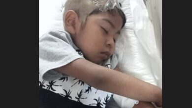 Photo of Ayudemos a Miguelito, tiene un tumor en la cabeza