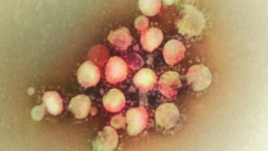 Photo of Reaparece coronavirus MERS, más letal que el covid-19, en Qatar y Omán