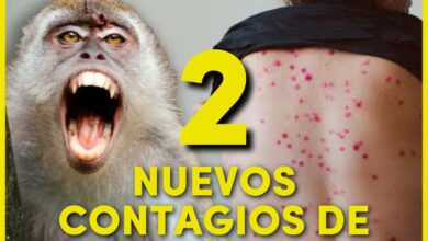 Photo of Dos nuevos casos de viruela del mono en Yucatán