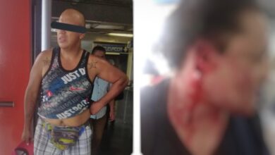 Photo of Hombre le arranca la oreja de una mordida a usuario en Metro de la CDMX