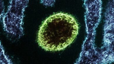 Photo of China identifica nuevo virus derivado de animales que ha infectado a 35 personas
