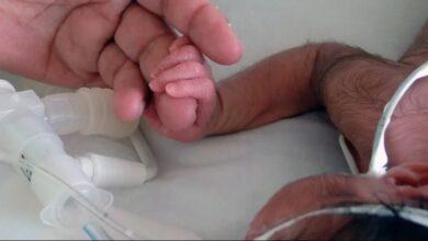 Photo of Extirpan “cola” a una bebé de dos meses en Nuevo León
