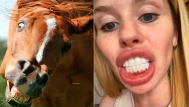 Photo of Joven se pone carillas dentales para lucir hermosa y ahora parece un caballo