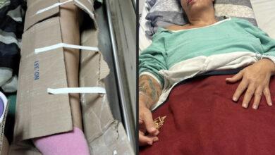 Photo of Le colocan un cartón para inmovilizar su fractura en el IMSS