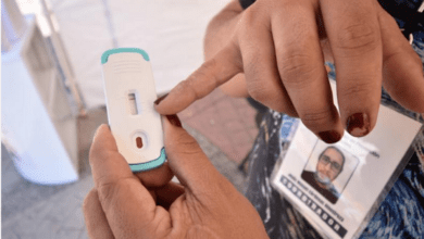 Photo of México desarrolla prueba para detectar VIH en 9 minutos