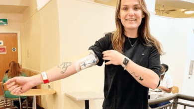 Photo of Consulta por “músculo desgarrado” y descubre que le quedan meses de vida