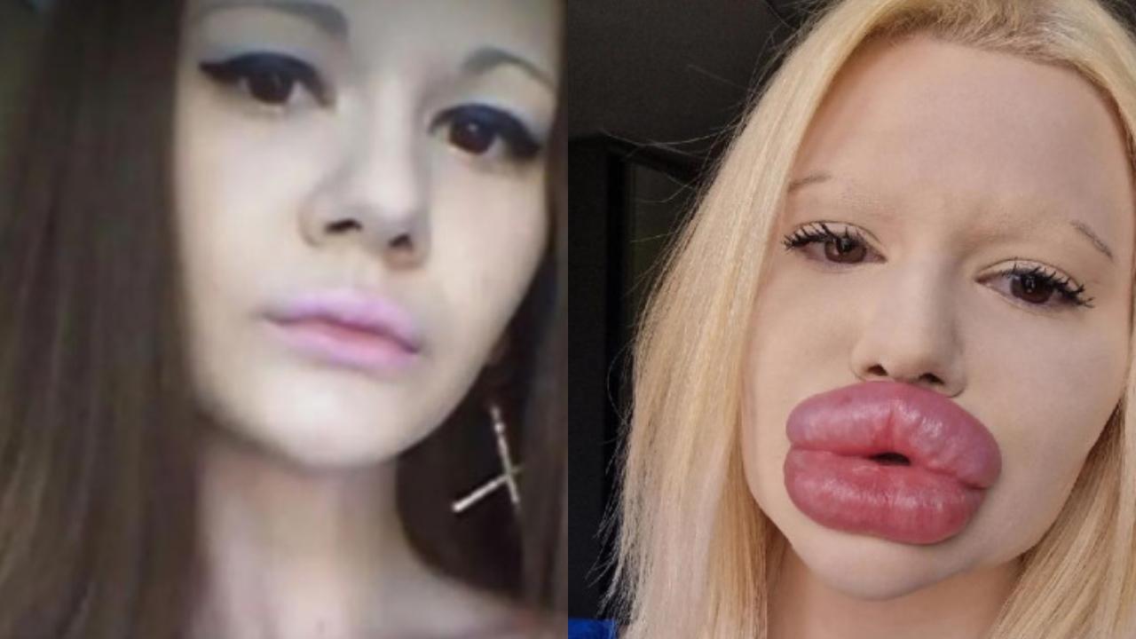 La mujer con los labios más grandes del mundo quiere agrandarlos más Con Acento