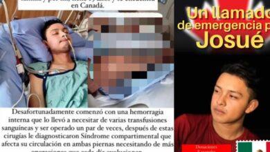 Photo of Yucateco en Canadá pide ayuda; podría perder las piernas
