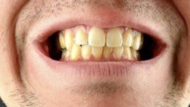 Photo of Nuevo medicamento japonés busca «regenerar» el crecimiento de los dientes