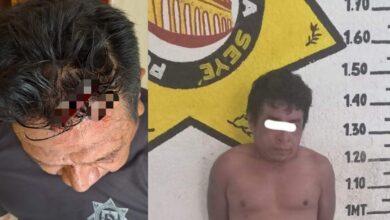 Photo of Machetean a policía de Seyé durante arresto