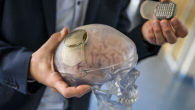 Photo of Científicos crean “atlas” de células cerebrales para curar trastornos mentales
