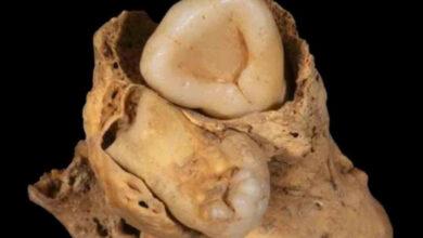 Photo of Científicos hallan un tumor con dientes en el antiguo Egipto