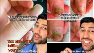 Photo of Uñas acrílicas pueden causar una infección ‘de pesadilla’