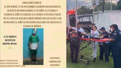 Photo of Niño agredido con machete podría perder un brazo; familia pide apoyo