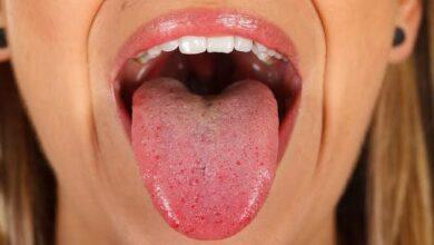 Photo of Acude al dentista y le extirpan parte de la lengua