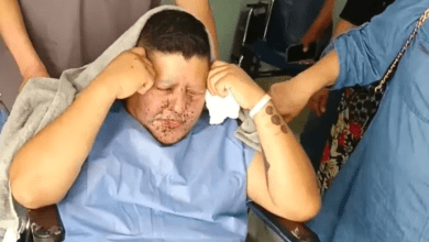 Photo of Payaso enciende cuete y le explota en la cara