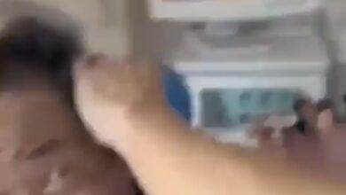 Photo of Hallan una araña dentro de la oreja de un hombre