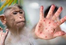 Photo of ¿Nueva pandemia? Hallan cepa mutante de viruela del mono