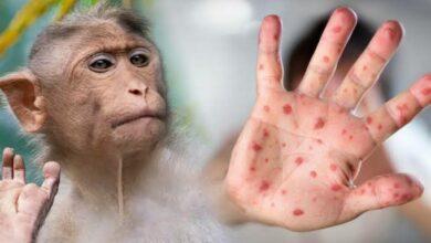 Photo of ¿Nueva pandemia? Hallan cepa mutante de viruela del mono
