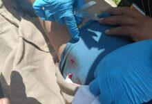 Photo of Hombre resulta lesionado por balines en la carretera Tizimín-Río Lagartos